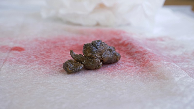 KBMS-074 第 4 部分 - 54 分钟