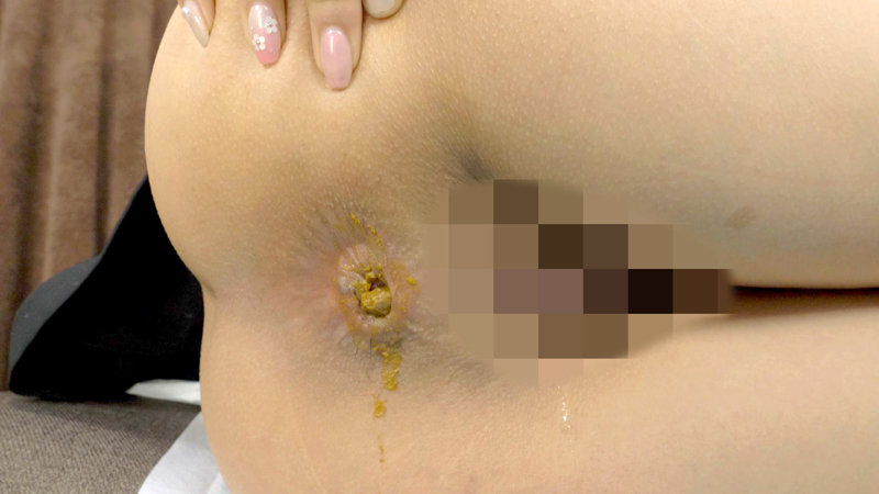 KBMS-131 パート 6 - 85 分