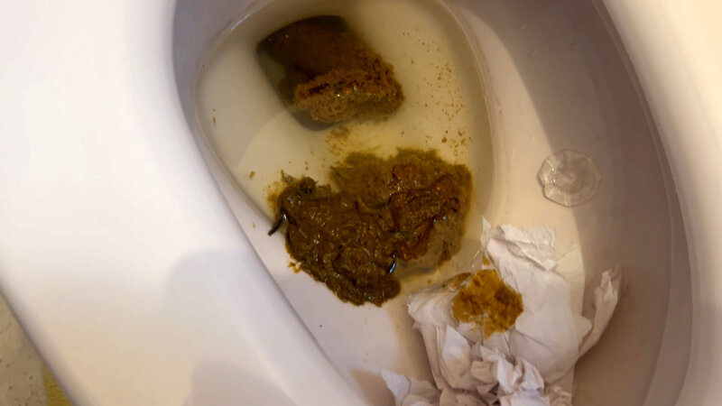 KBMS-194 パート 10 - 120 分