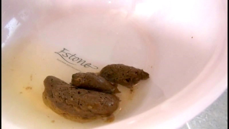 ODV-335 パート 10 - 66 分