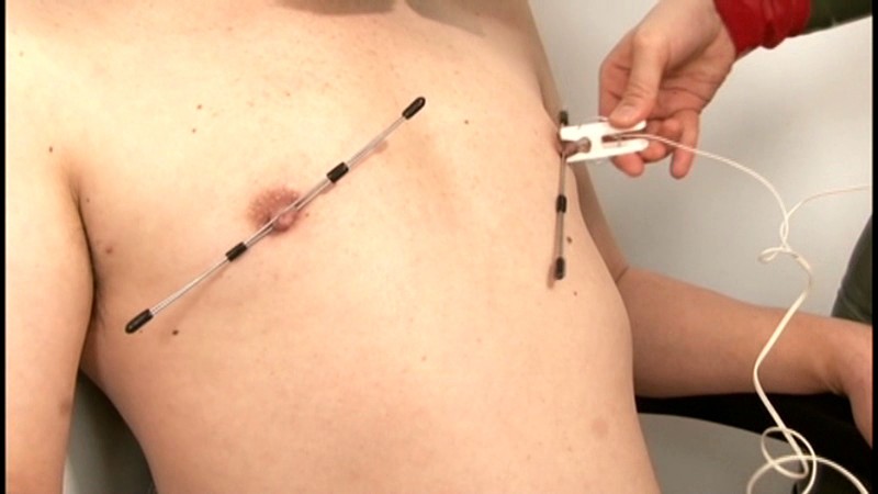 QRDA-003 第 14 部分 - 95 分钟