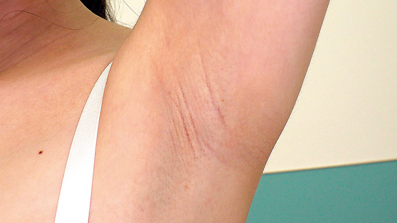 SABA-740 Bagian 18 - 285 minit