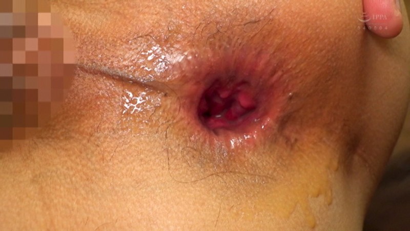 TCD-260 第 7 部分 - 78 分钟