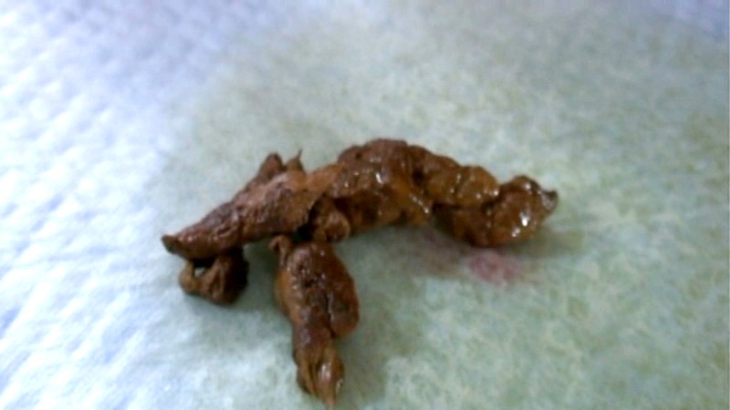 TMGP-001 Bagian 17 - 94 minit