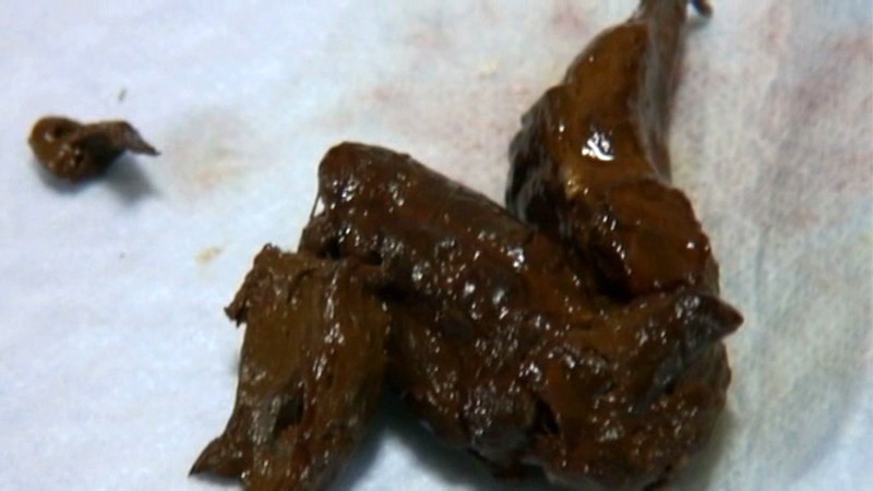 TMGP-001 Bagian 20 - 106 minit