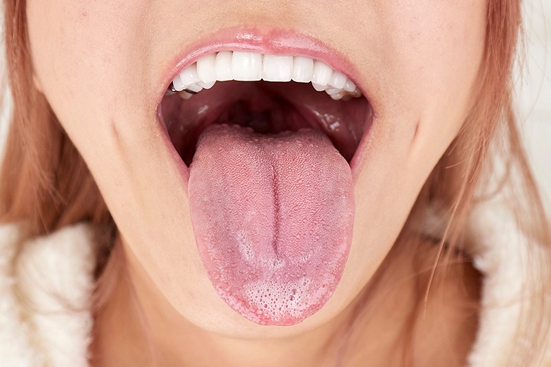 VRKM-200 Bagian 3 - 42 minit