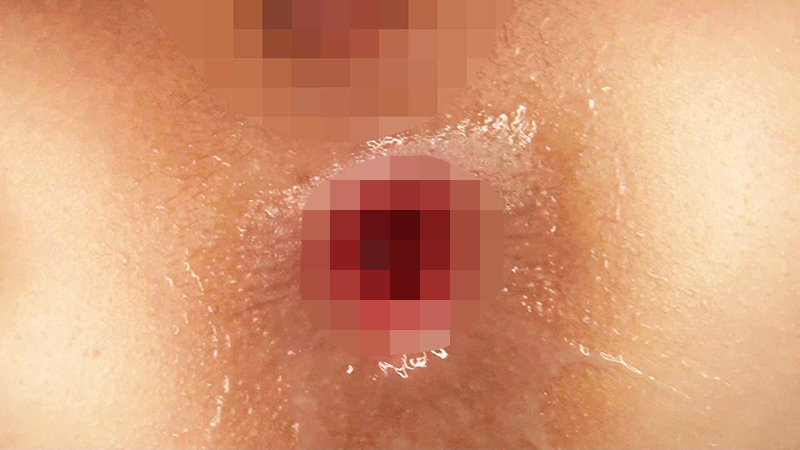 XRLE-018 Bagian 18 - 149 minit