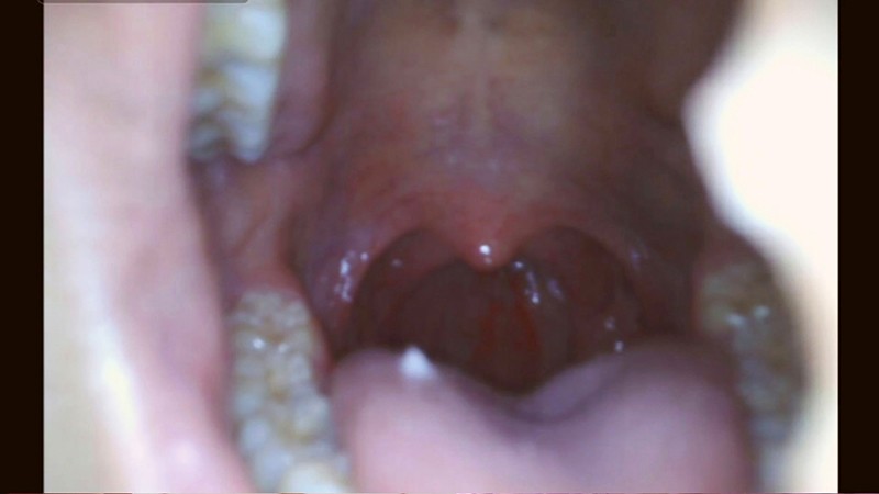 XRW-998 Bagian 5 - 70 minit