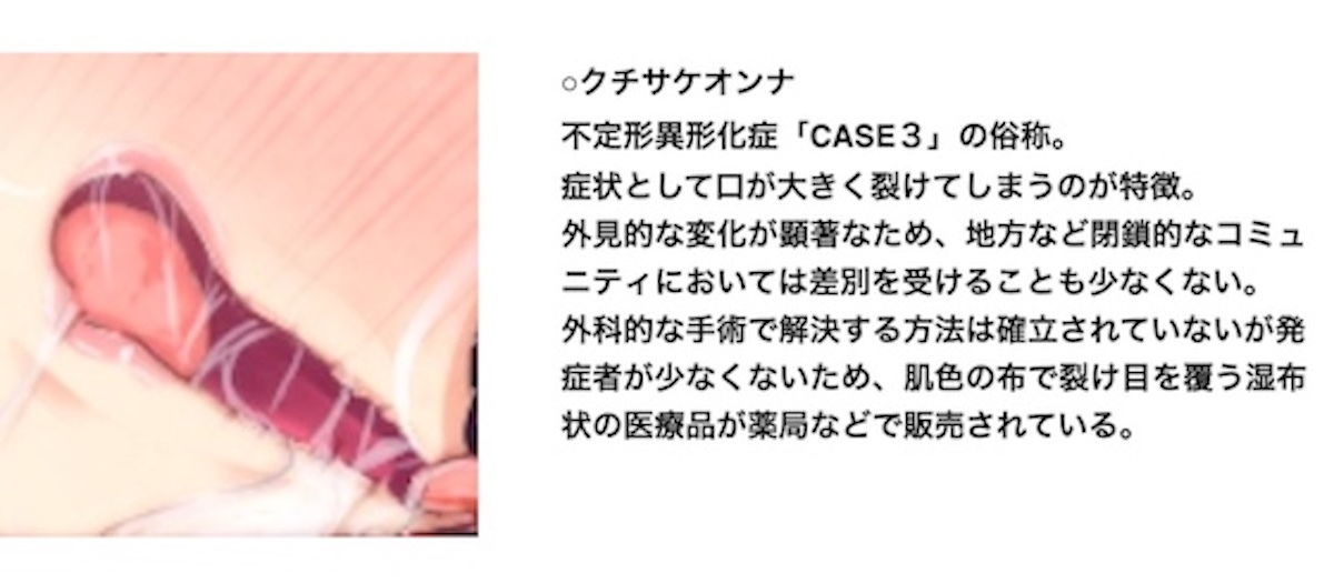 サンプル画像5:口裂けVメリヰゴオランド〜都市伝説風俗で再会したアタシたち〜(百合虎魂) [d_194432]